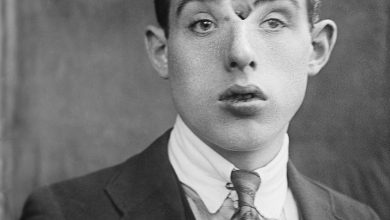 Sueño truncado: La trágica historia de Paloma Nicole, la joven de 14 años que falleció tras una cirugía estética