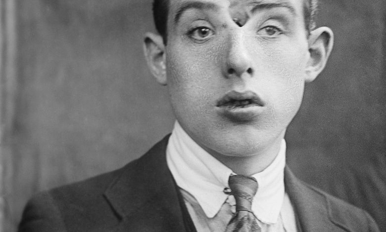 Sueño truncado: La trágica historia de Paloma Nicole, la joven de 14 años que falleció tras una cirugía estética